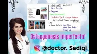 Что такое несовершенный остеогенез?