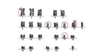 BCR-ABL1 and the Philadelphia chromosome - Part 1: Normal and aberrant karyograms