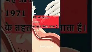 Abortion कब Legal है? 🏥 MTP Act Explained in 1 Min #shorts