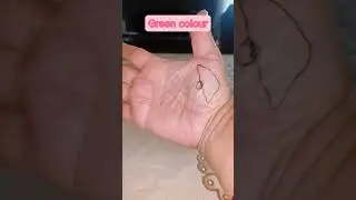 Colour therapy for stone in gallbladder.#shortsvideo #acupressure #nepali
