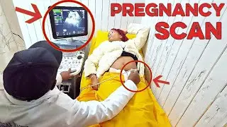 Ultrasound Pregnancy Scan Results😳, Boy Or Girl?