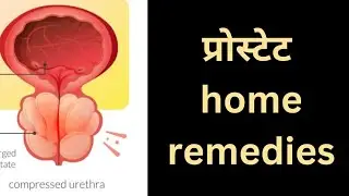 Prostate gland home remedies|prostate kya hota hai|prostate gland urinary problems|prostate exercise