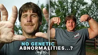 This is the reason for Jeff Dabe's gigantic hands!