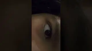 How are people getting viral because of there eye color