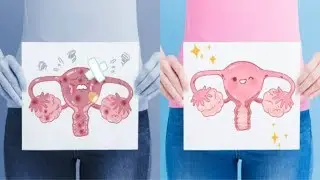 How to Unblock Your Fallopian Tubes Naturally Part 2