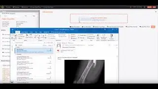 Dragging and Dropping Emails directly into OpenContent Management Suite