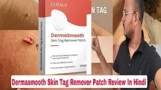 Derma Smooth Skin Tag Removal Patch Review In Hindi 