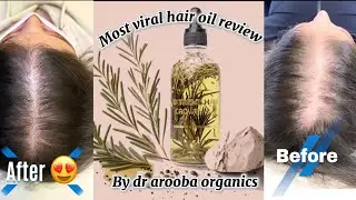 Honest review of DR arooba&rsquo;s organic hair growth oil | How to use | Benefits