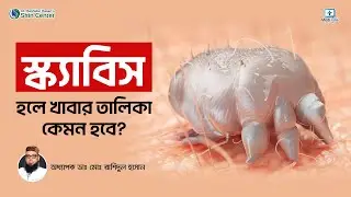 স্ক্যাবিসের রোগীরা কি খাবেন? | Diet for Scabies | Scabies Treatment Bangla #scabies