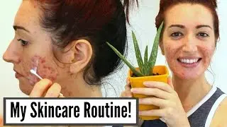 My Current Skincare Routine For Severe Acne & Scarring // Oily Skin Treatments