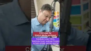 Breast Stretch Marks Treatment | CO2 Laser by Dr Goyal | Kayakalp Muktsar