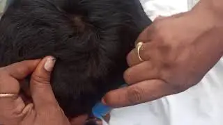 licecombing by bro with lots of lices/realsounds/in Telugu@TArajakiyalu