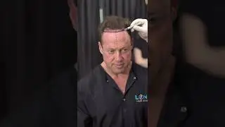 Dhı Hair Transplant ~Long Hair Center