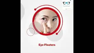 10 Common Eye Problems   #KiranopticalDeoband #EyeProblem #EyeCare #OpticalDeoband