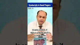 Advanced Surgery for Congenital Hand Problems