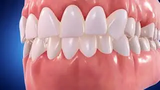 Studio Dentistico Digitale - Invisalign