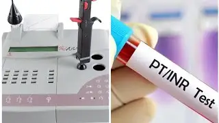 طريقة عمل تحليل Prothrombin time ( Pt ) وقيمة INR على جهاز ستاكو Stago