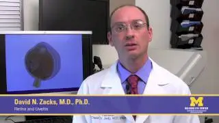 What is a detached retina and what are the causes?