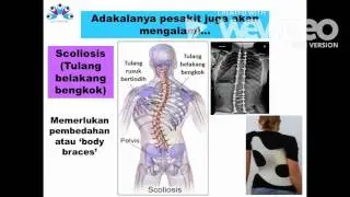 Spinal Muscular Atrophy Malaysia (SMA Malaysia)
