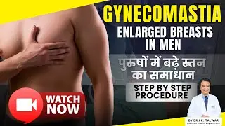Gynecomastia Surgery Explained | पुरुषों में बढ़े स्तन का समाधान | Expert Guide By Dr. PK Talwar