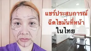 เจ๊เป็กรีวิว ฉีดไขมันหน้า ที่ไทยกับ คุณหมอจูน Classy Clinic