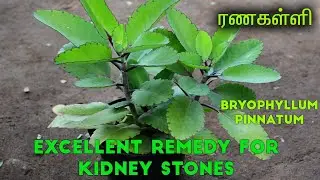 Best remedy for kidney stones | Ranakalli Plant | Bryophyllum pinnatum