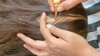ASMR Full Scalp Check Up, Lice Removal, Sensory Tests, Skin exam & Treatment 🌿