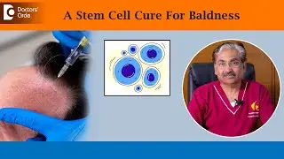 Stem Cell Treatment For Hair Loss| Revolutionary Hair Therapy - Dr.Venkataram Mysore|Doctors' Circle