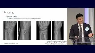 12  Distal Radius Fractures   Anthony Ding, MD