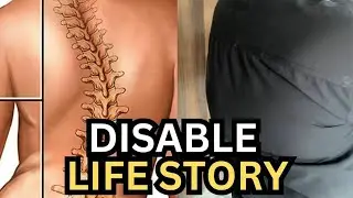 Disable Life Story 😞  Disable Kis Wajh Sey Howa 😒Please Me #vlog #shorts #shortsfeed