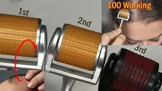 Hair regrowth Treatment using Derma roller or difference between 2 derma roller micro needling