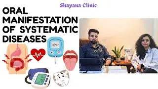 Oral Manifestation of Systematic Diseases Dr.Shadab & Dr. Nida Talks | Hindi #ShayanaClinic #viral