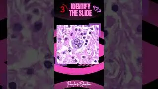 Identify The Slide! | Pathology Slides | #neetpg #fmge #inicet #pyq #pathology