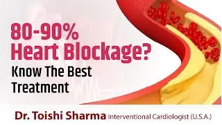 Best Treatment of 80-90% Blockage | Heart Blockage Treatment In USA - Dr Toishi Sharma