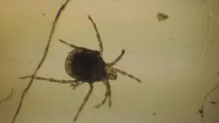Leben im Wassertropfen - Mikroskopie von Flusswasser - Kleinstlebewesen