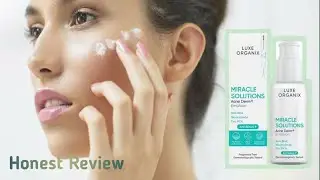 Luxe Organix (Miracle Solutions + Acne Derm Emulsion) Real Talk!