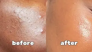 how to get rid of textured skin | good molecules pm skincare routine