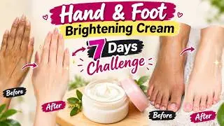 Winter hand and foot whitening cream | skin whitening home remedy