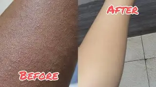 Get Rid of Tan on Hands & Arms | Budget-Friendly Detan Products That Work!