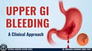 Upper Gastrointestinal Bleeding: A Clinical Approach