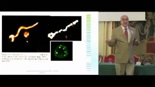 Dr. Alan MacDonald, Borrelia - diverse Morphologies, NorVect 2014