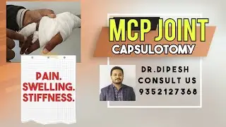 Role of physiotherapy in MCP joint Capsulotomy #stiffness#pain#swelling#muscles wasting#grip #power