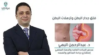 فتق جدار البطن و ترهلات البطن مع د.عبدالرحمن البهي - دكتور جراحة عامة بالمنصورة