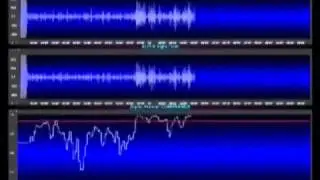 EEG Demo practising TM - Dr. Alarik Arenander 2min