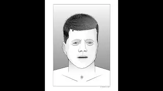 The Missing JFK Autopsy Photos