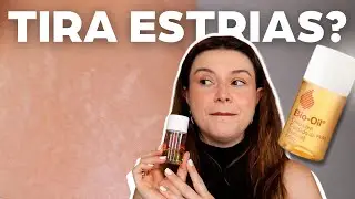 Usei o BIO-OIL por 30 dias e olha o que aconteceu