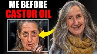 I Removed My Eye Bags in 30 Days With Castor Oil&mdash;Here&rsquo;s How! | Barbara O&rsquo;Neill