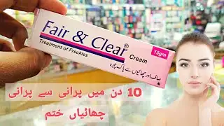 Fair And Clear Cream | Freckles | pigmentation | Dark spots | For Face |