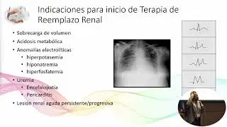 Salvando Vidas: Innovación en Purificación Sanguínea para Pacientes Críticos - Dr Lopez