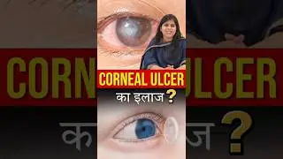 Treatment Of Corneal Ulcer I Tectonic Graft Surgery Procedure